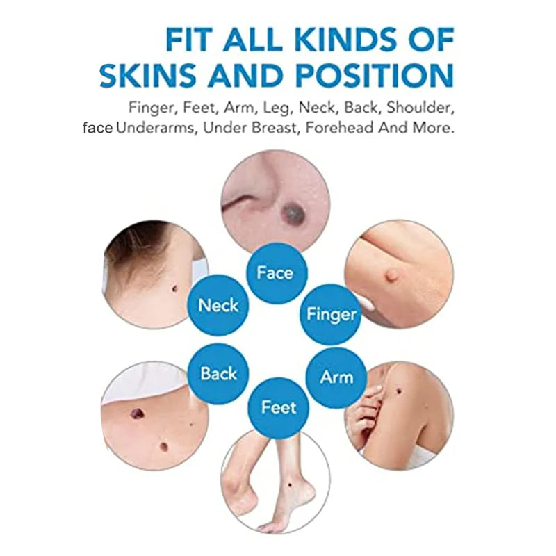 Cleartag™ Painless Skin Tag & Mole Removal Kit